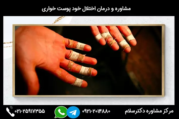 بررسی کامل علائم، علل و درمان درماتوفاژی